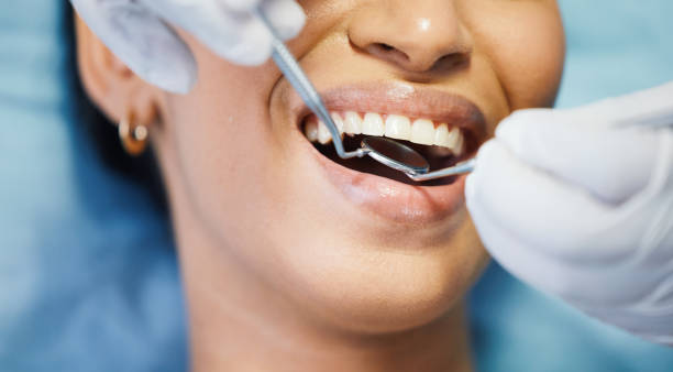 Best Broken or Chipped Tooth Repair in Seminole, OK
